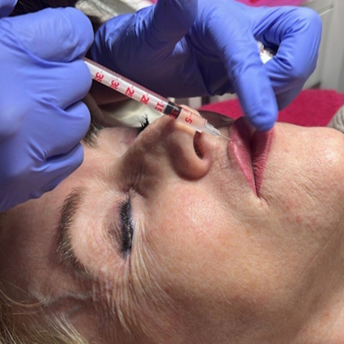Botox & Hyaluron zugeschnitten